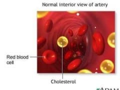 Turmeric Benefits for Cholesterol Turmeric Benefits for Cholesterol