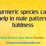 How To Treat Male Pattern Baldness Naturally How To Treat Male Pattern Baldness Naturally