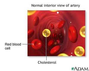 What are some tips to keep cholesterol within the normal range?