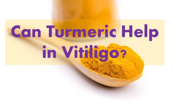 Can Turmeric Help in Vitiligo