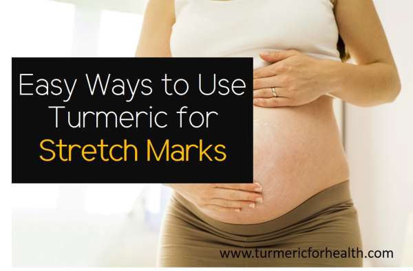 Easy Ways to Use Turmeric for Stretch marks