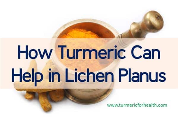 How Turmeric Can Help in Lichen Planus