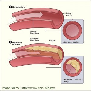 turmeric for atherosclerosis